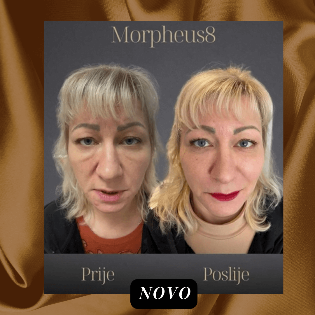 Morpheus - prije i poslije