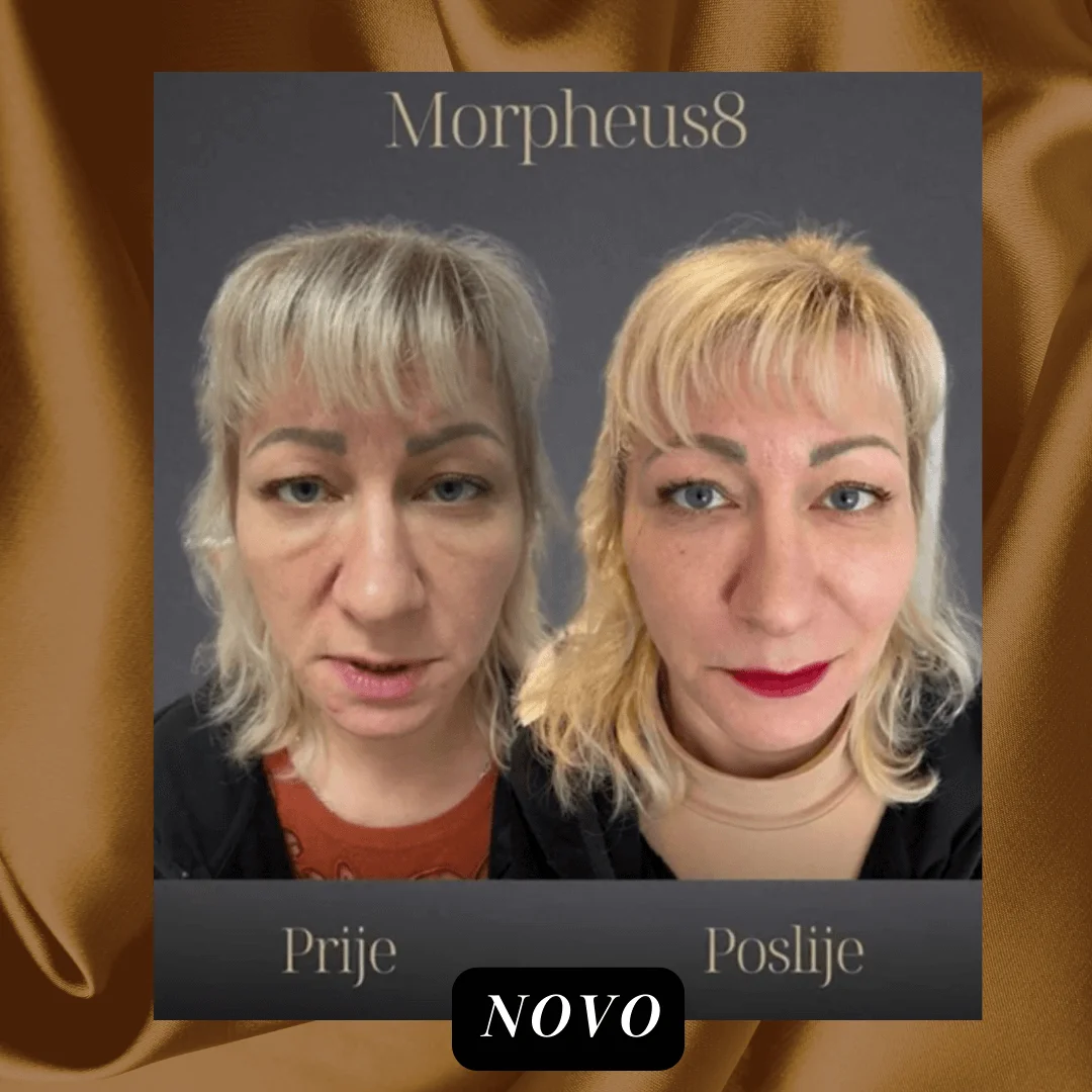 Morpheus - prije i poslije